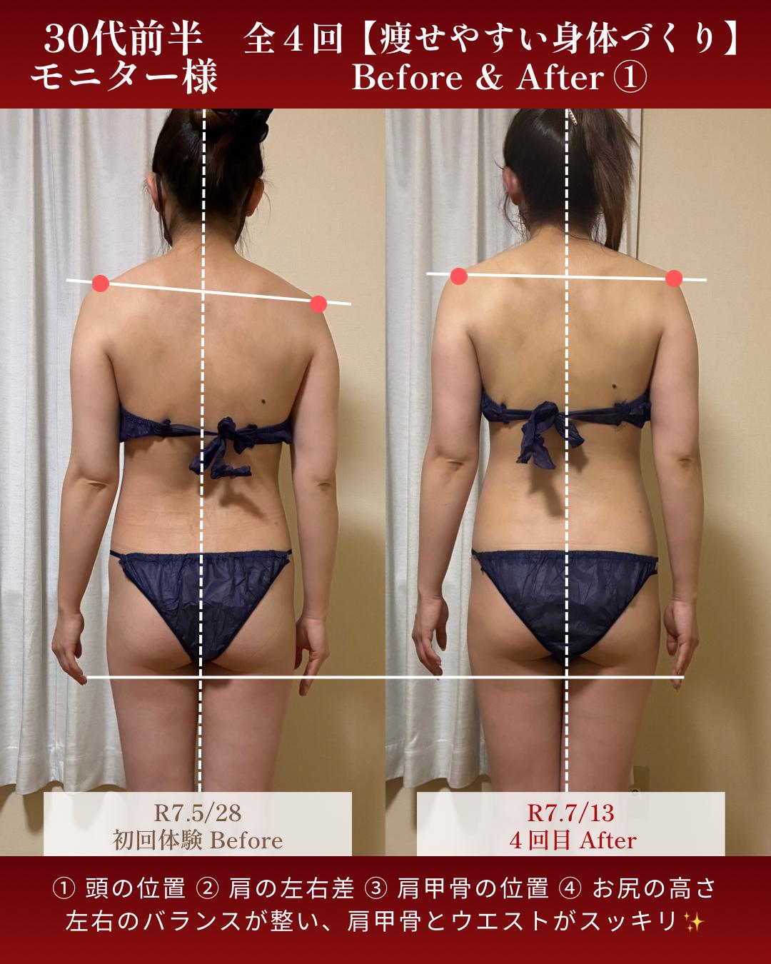 旭川市コアヒート専門温活エステサロンyunariの結果写真